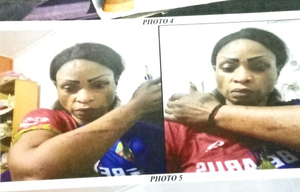 Violences Conjugales : Audrey Ngo Yetna Victime des Exactions de son Époux Fabien Chicot
